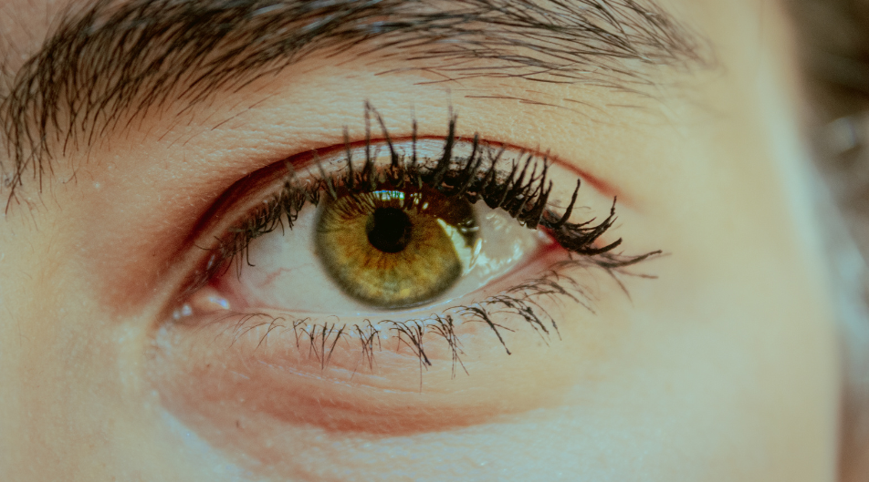 Occhiaie persistenti: consigli e rimedi